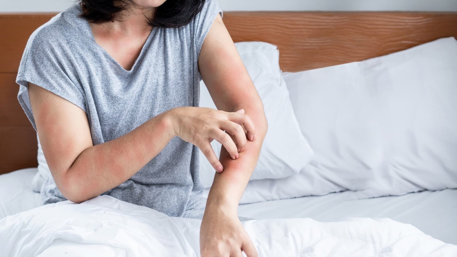 7 Key Symptoms, Causes, and Treatments of HIV Rash in Bangkok, Thailand 2 Causes of HIV Rash